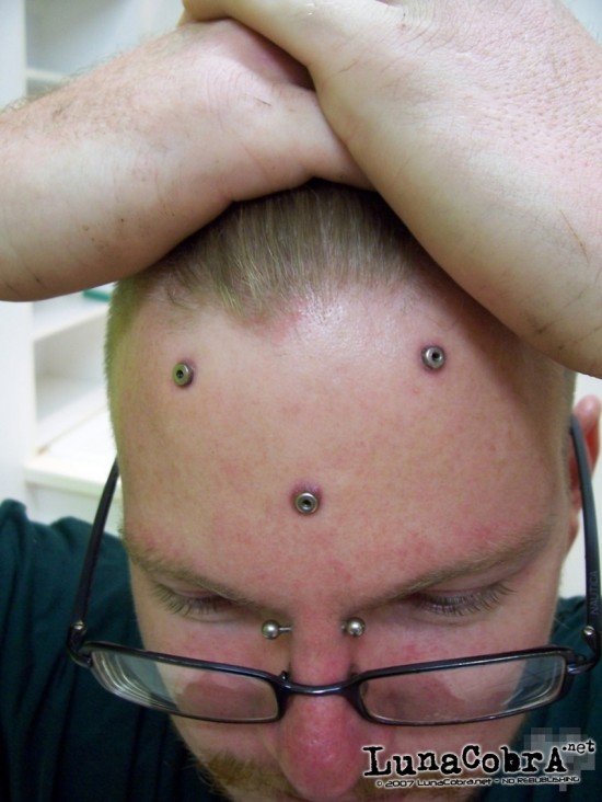 Transdermals Transdermals