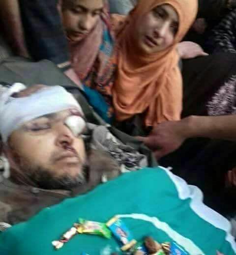Indian troops continue state terrorism in occupied Kashmir, martyred a three feet tall Kashmiri Noor Mohammad Trantray in Pulwama, body recovered from the debris of a house